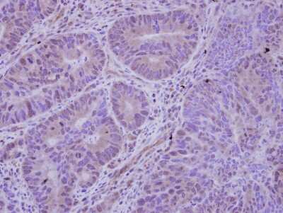 Immunohistochemistry-Paraffin: HDAC7 Antibody [NBP2-16795]