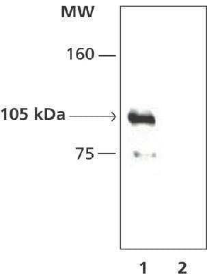 Immunoprecipitation: HDAC7 Antibody [NB100-2146]