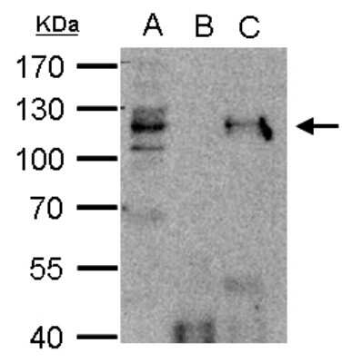 Immunoprecipitation: HDAC7 Antibody [NBP2-16795]