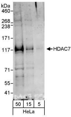 Western Blot: HDAC7 Antibody [NB100-61587]