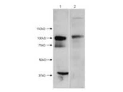 Western Blot: HDAC7 Antibody [NBP1-44092]