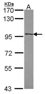 Western Blot: HDAC7 Antibody [NBP2-16795]