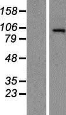 Western Blot: HDAC7 Overexpression Lysate [NBP2-07000]