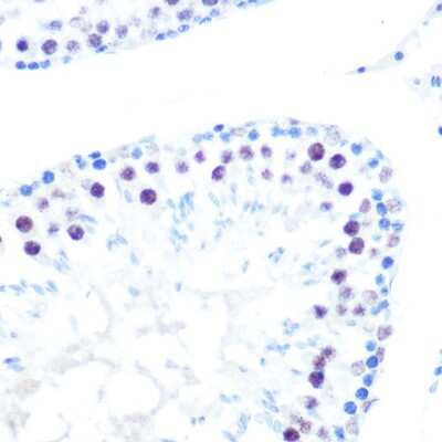 Immunohistochemistry-Paraffin: HDAC9 Antibody (3L5E5) [NBP3-16097]