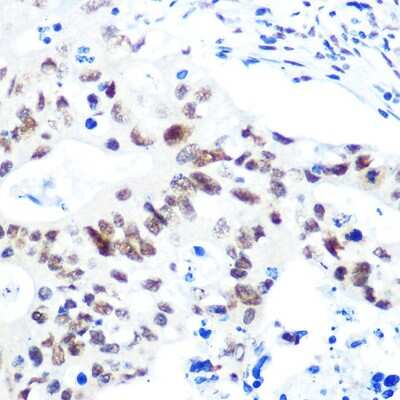 Immunohistochemistry-Paraffin: HDAC9 Antibody (3L5E5) [NBP3-16097]