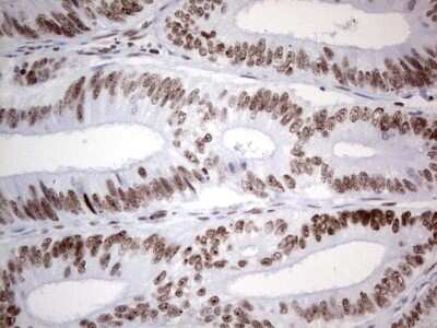 Immunohistochemistry: HDAC9 Antibody (OTI7G2) [NBP2-45952]