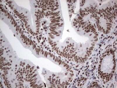Immunohistochemistry: HDAC9 Antibody (OTI7G2) [NBP2-45952]