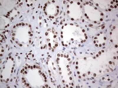 Immunohistochemistry: HDAC9 Antibody (OTI7G2) [NBP2-45952]