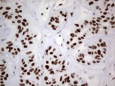 Immunohistochemistry: HDAC9 Antibody (OTI7G2) [NBP2-45952]