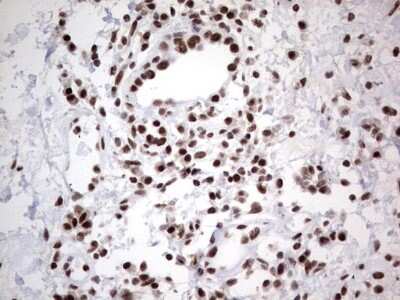 Immunohistochemistry: HDAC9 Antibody (OTI7G2) [NBP2-45952]