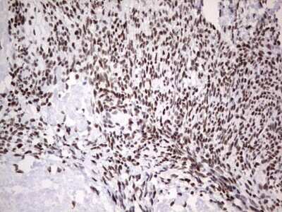 Immunohistochemistry: HDAC9 Antibody (OTI7G2) [NBP2-45952]
