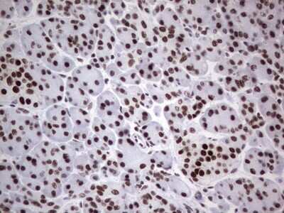 Immunohistochemistry: HDAC9 Antibody (OTI7G2) [NBP2-45952]