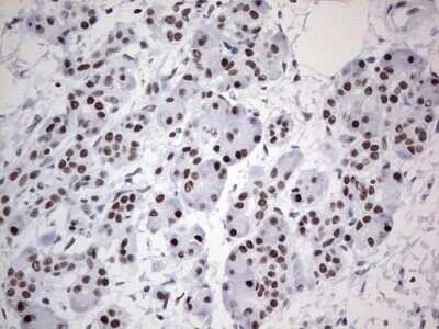 Immunohistochemistry: HDAC9 Antibody (OTI7G2) [NBP2-45952]