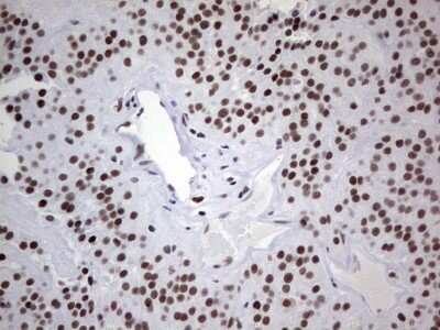 Immunohistochemistry: HDAC9 Antibody (OTI7G2) [NBP2-45952]