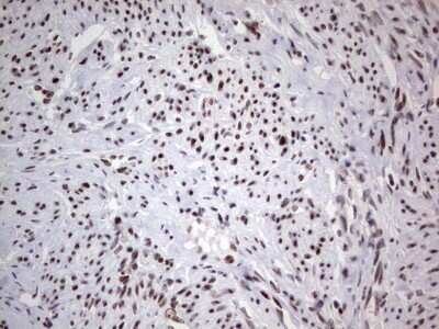 Immunohistochemistry: HDAC9 Antibody (OTI7G2) [NBP2-45952]