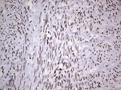 Immunohistochemistry: HDAC9 Antibody (OTI7G2) [NBP2-45952]