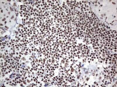 Immunohistochemistry: HDAC9 Antibody (OTI7G2) [NBP2-45952]