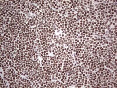 Immunohistochemistry: HDAC9 Antibody (OTI7G2) [NBP2-45952]