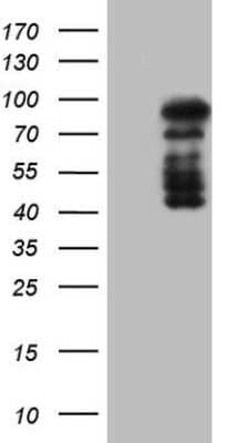 Western Blot: HDAC9 Antibody (OTI7G2) [NBP2-45952]