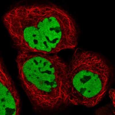 Immunocytochemistry/ Immunofluorescence: HDAC9 Antibody [NBP1-83274]