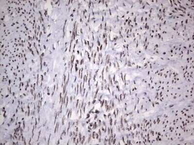 Immunohistochemistry: HDAC9 Antibody (OTI7G2) - Azide and BSA Free [NBP2-71493]