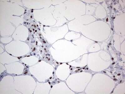 Immunohistochemistry: HDAC9 Antibody (OTI7G2) - Azide and BSA Free [NBP2-71493]