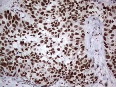 Immunohistochemistry: HDAC9 Antibody (OTI7G2) - Azide and BSA Free [NBP2-71493]