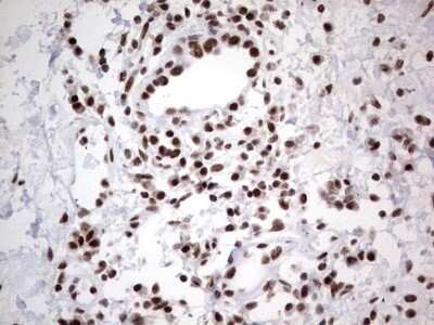 Immunohistochemistry: HDAC9 Antibody (OTI7G2) - Azide and BSA Free [NBP2-71493]