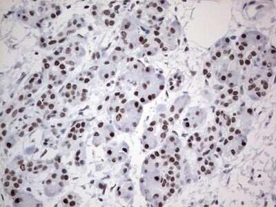 Immunohistochemistry: HDAC9 Antibody (OTI7G2) - Azide and BSA Free [NBP2-71493]