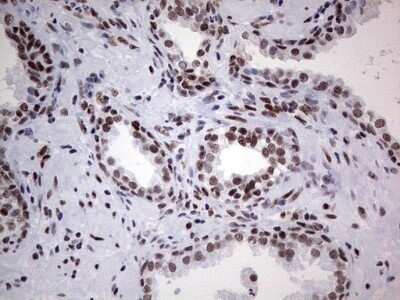 Immunohistochemistry: HDAC9 Antibody (OTI7G2) - Azide and BSA Free [NBP2-71493]