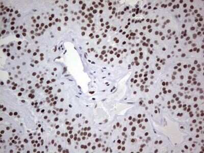 Immunohistochemistry: HDAC9 Antibody (OTI7G2) - Azide and BSA Free [NBP2-71493]