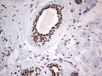 Immunohistochemistry: HDAC9 Antibody (OTI7G2) - Azide and BSA Free [NBP2-71493]