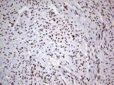 Immunohistochemistry: HDAC9 Antibody (OTI7G2) - Azide and BSA Free [NBP2-71493]