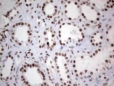 Immunohistochemistry: HDAC9 Antibody (OTI7G2) - Azide and BSA Free [NBP2-71493]