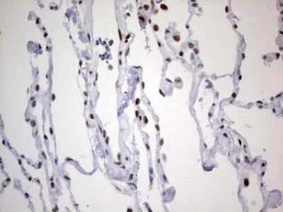 Immunohistochemistry: HDAC9 Antibody (OTI7G2) - Azide and BSA Free [NBP2-71493]