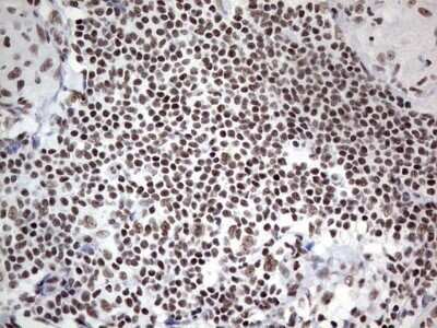 Immunohistochemistry: HDAC9 Antibody (OTI7G2) - Azide and BSA Free [NBP2-71493]