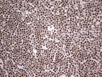Immunohistochemistry: HDAC9 Antibody (OTI7G2) - Azide and BSA Free [NBP2-71493]