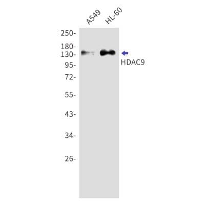 Western Blot: HDAC9 Antibody (S01-8I6) [NBP3-19871]