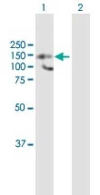 Western Blot: HDAC9 Antibody [H00009734-B01P]