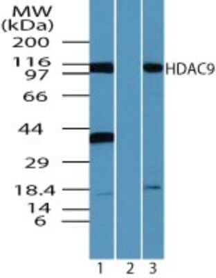 Western Blot: HDAC9 AntibodyBSA Free [NBP2-03993]