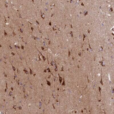 Immunohistochemistry-Paraffin: HDC Antibody [NBP1-90985]