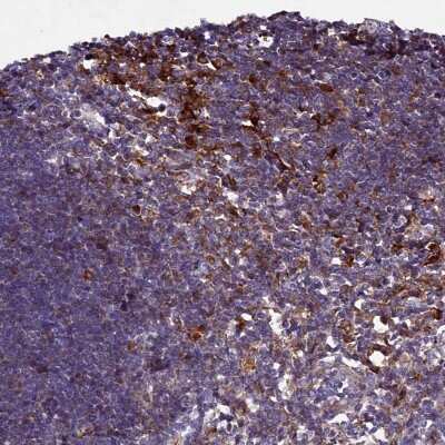 Immunohistochemistry-Paraffin: HDC Antibody [NBP1-90985]