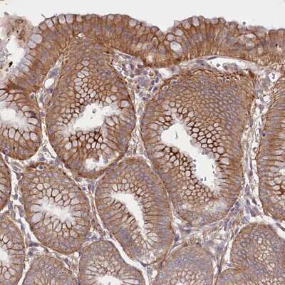 Immunohistochemistry-Paraffin: HDC Antibody [NBP1-90985]