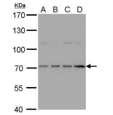 Western Blot: HDC Antibody [NBP2-16797]