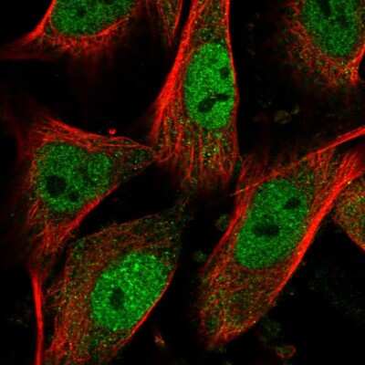 Immunocytochemistry/ Immunofluorescence: HDC2/PHC2 Antibody [NBP1-91979]