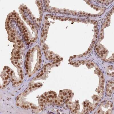 Immunohistochemistry-Paraffin: HDC2/PHC2 Antibody [NBP1-91979]