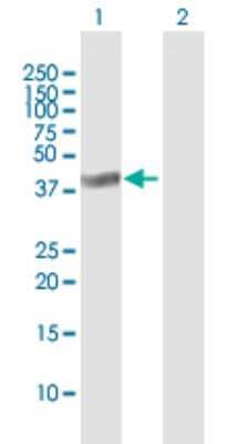 Western Blot: HDC2/PHC2 Antibody [H00001912-B01P]