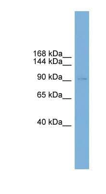 Western Blot: HDC2/PHC2 Antibody [NBP1-79447]