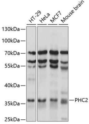 Western Blot: HDC2/PHC2 AntibodyAzide and BSA Free [NBP3-03382]