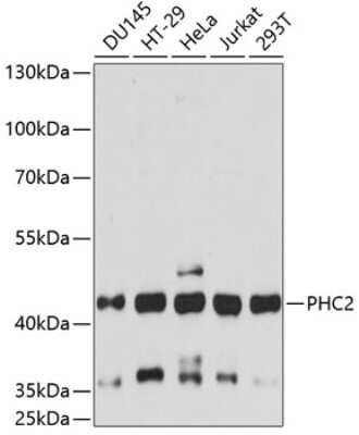 Western Blot: HDC2/PHC2 AntibodyAzide and BSA Free [NBP3-03609]